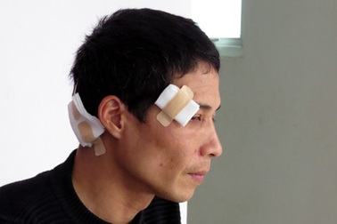 Hà Nội: Tranh chấp đất, cháu bị cả nhà chú ruột hành hung