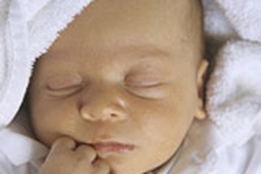 Viêm da kích ứng do tiếp xúc với nước xả vải