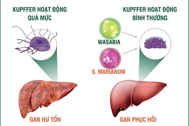 Cảnh báo viêm gan và những hậu quả nguy hiểm