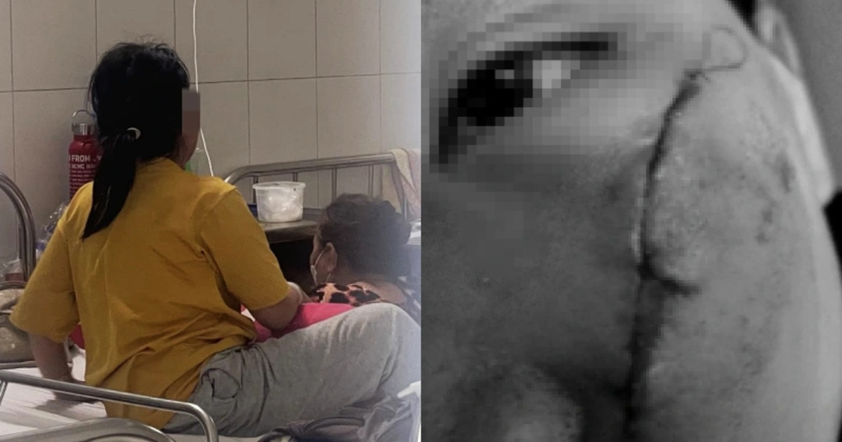 Bé gái co giật sau khi bị đánh bằng xẻng tại mái ấm ở TPHCM hiện ra sao?