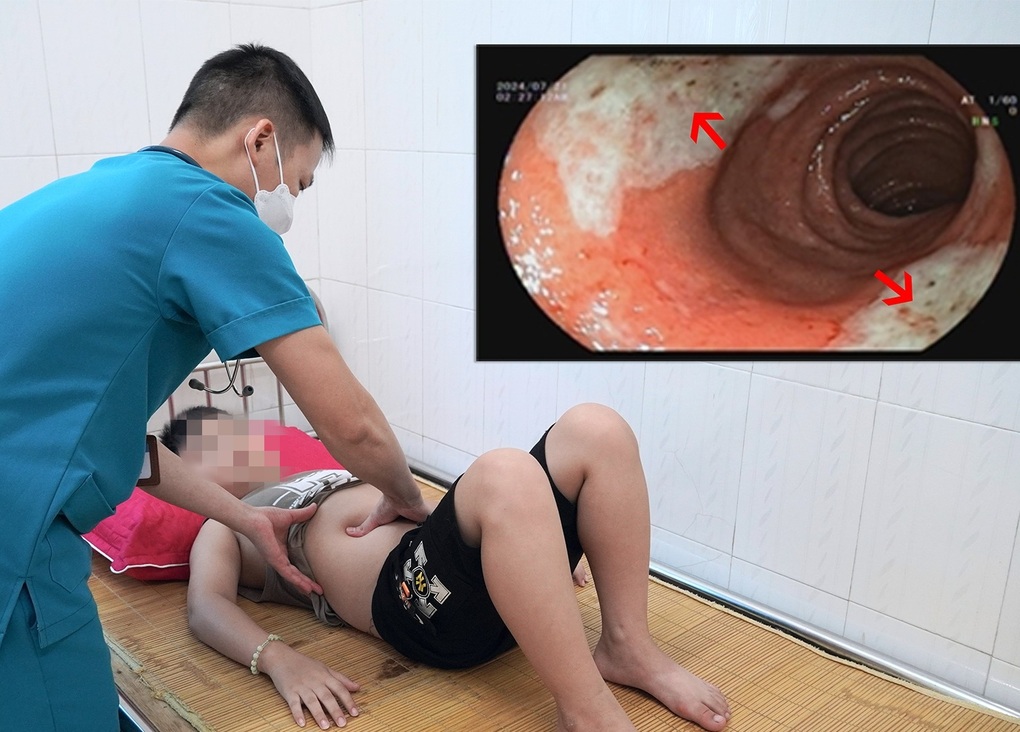 Trẻ nhập viện vì sai lầm của cha mẹ khi cho con dùng thuốc hạ sốt - 1 Trẻ nhập viện vì sai lầm của cha mẹ khi cho con dùng thuốc hạ sốt - 1