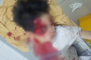 Nghi án ô tô kéo lê bé trai hơn 100m: Tài xế đến trình diện công an