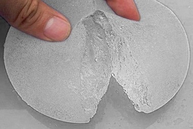 Nổ túi ngực khi đi máy bay: Bác sĩ lý giải sự thật bất ngờ