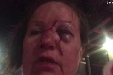 Du khách lãnh đòn oan khi đứng quay video đánh nhau