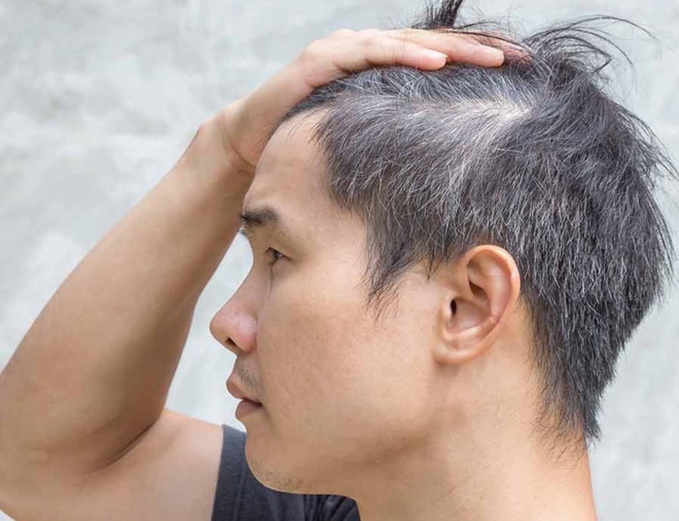 Sắc mun - dầu gội phủ bạc giúp tóc đen bóng trở lại - 1