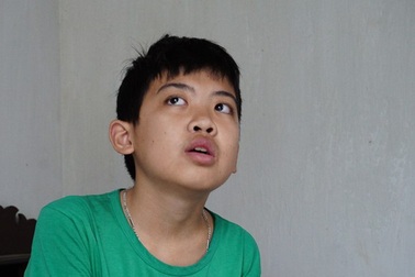 Thương cậu bé không cha đối mặt với nguy cơ biến mất cả hàm răng