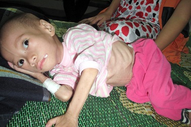 Xót thương bé trai 3 tuổi chỉ còn da bọc xương