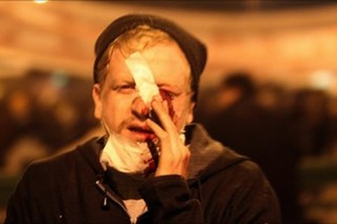 Ai Cập: Hàng trăm người thương vong, biểu tình vẫn tiếp diễn