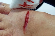 Chó dữ vào chợ cắn 7 người bị thương