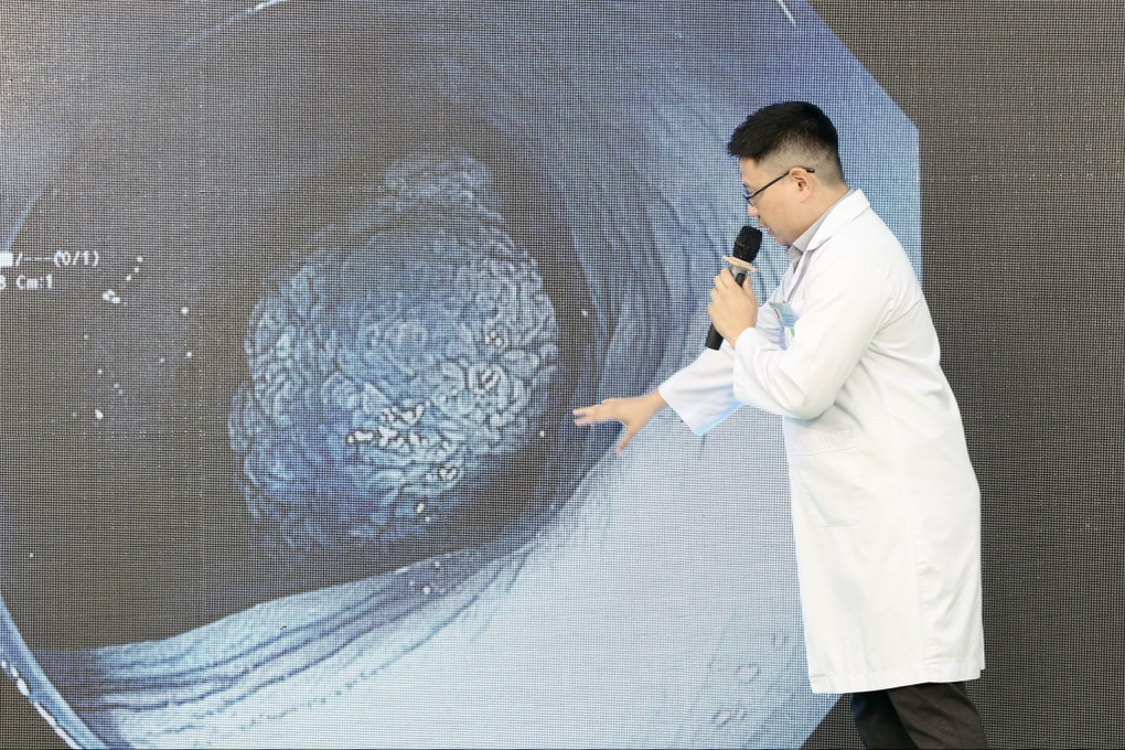 Tọa đàm trực tuyến: Công nghệ nội soi phát hiện và xử gọn ung thư tiêu hóa - 2 Tọa đàm trực tuyến: Công nghệ nội soi phát hiện và xử gọn ung thư tiêu hóa - 2