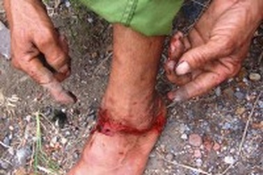 Hỗn chiến giữa công nhân Công ty cao su và dân địa phương