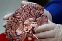 Hình ảnh lưu trữ não người tại một ngân hàng não ở Mỹ