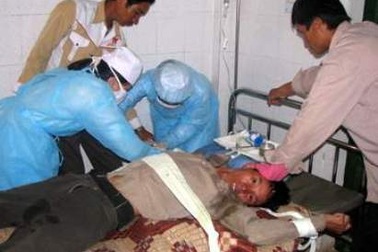 Một thanh niên tử vong sau 3 tháng bị chó cắn