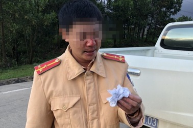 "Thông" chốt kiểm dịch, nam thanh niên tấn công Cảnh sát giao thông