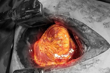 Cứu sống một phụ nữ bị đâm thấu tim và gan