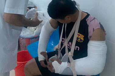 Shipper bị khách "bom hàng" đánh gãy 2 tay có gia cảnh khó khăn