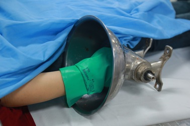 Hà Nội: Người phụ nữ kẹt cả bàn tay trong máy xay thịt