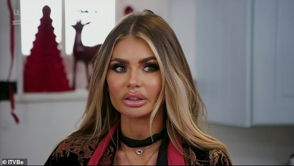 Chloe Sims tuyên bố chưa từng chỉnh sửa gương mặt - 1 Chloe Sims tuyên bố chưa từng chỉnh sửa gương mặt - 1