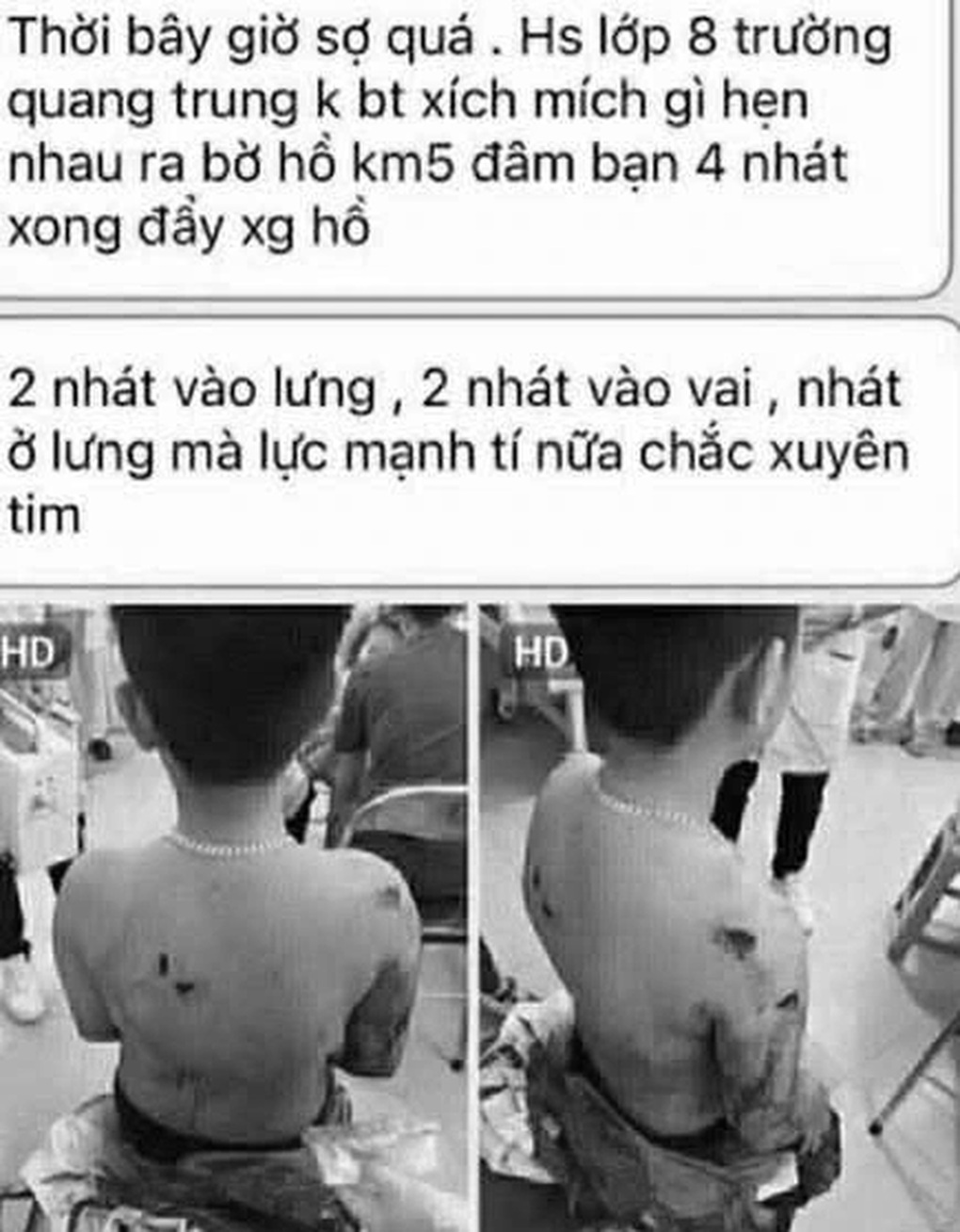 Nam sinh lớp 8 hành hung rồi hất bạn xuống hồ nước - 2 Nam sinh lớp 8 hành hung rồi hất bạn xuống hồ nước - 2