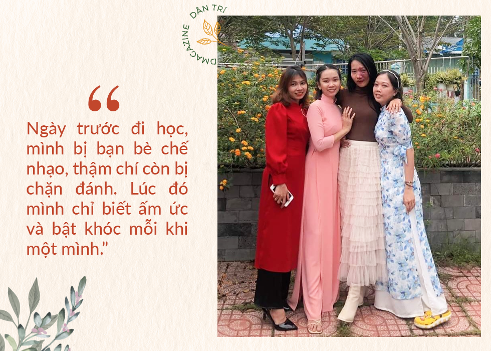 Cô giáo trẻ sống vui vẻ, tự tin với vết bớt chiếm một phần tư gương mặt - 5 Cô giáo trẻ sống vui vẻ, tự tin với vết bớt chiếm một phần tư gương mặt - 5