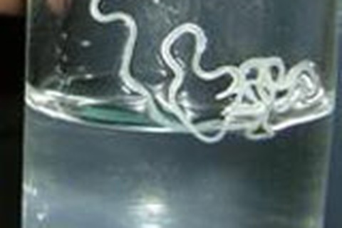 Giun chui vào mắt