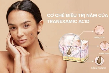 Sử dụng Tranexamic Acid trị nám như thế nào đạt hiệu quả cao?
