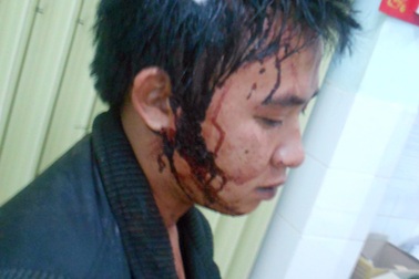 Công an xã bị tố dùng súng "giải quyết" vụ vi phạm giao thông