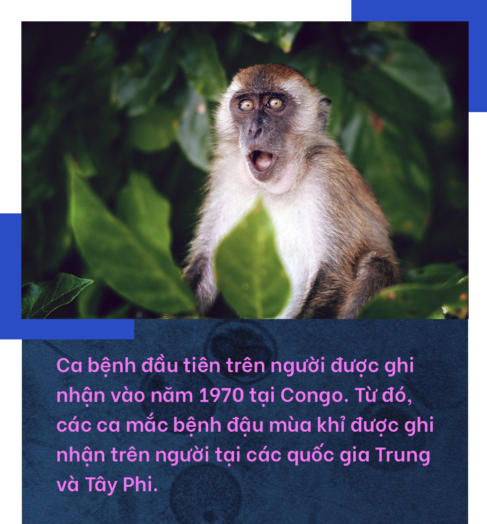 Đậu mùa khỉ: Vì sao căn bệnh bị xóa sổ 40 năm trước khiến WHO họp khẩn? - 4 Đậu mùa khỉ: Vì sao căn bệnh bị xóa sổ 40 năm trước khiến WHO họp khẩn? - 4