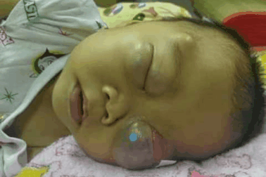 Xót xa cảnh cháu bé 3 tuổi quằn quại trong cơn đau vì ung thư quái ác hành hạ