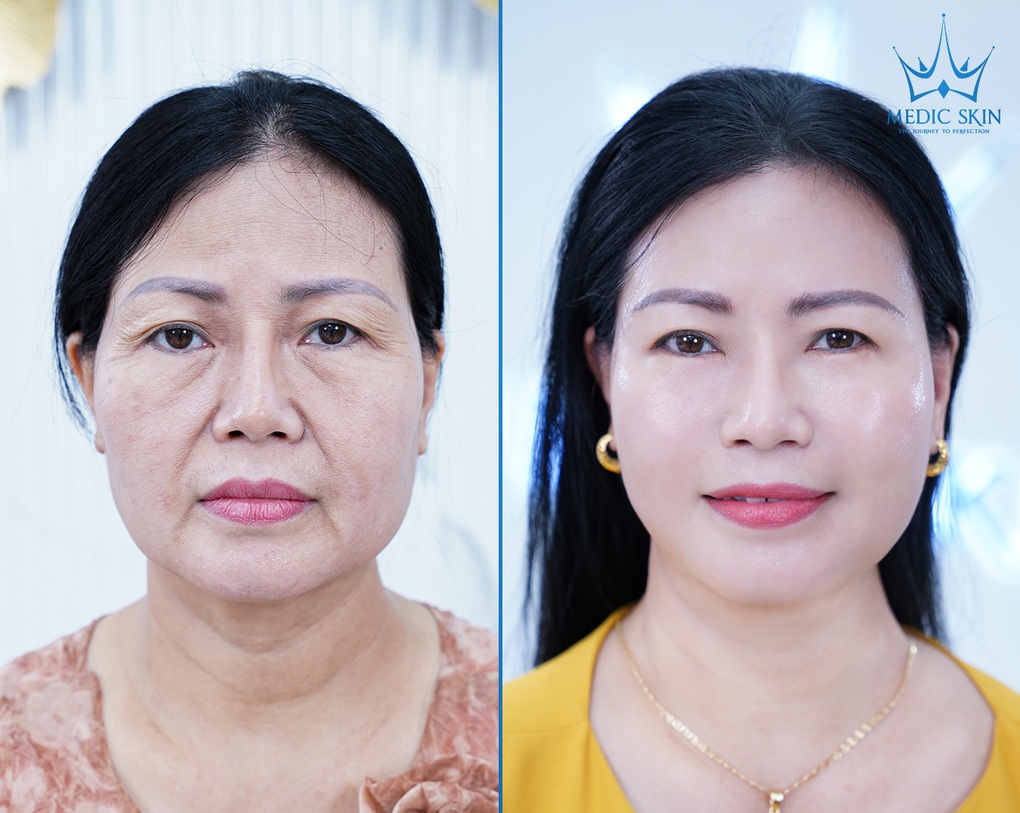 Viện Thẩm mỹ Quốc tế Medic Skin - Nơi làm đẹp cho hàng triệu khách hàng Việt - 4 Viện Thẩm mỹ Quốc tế Medic Skin - Nơi làm đẹp cho hàng triệu khách hàng Việt - 4