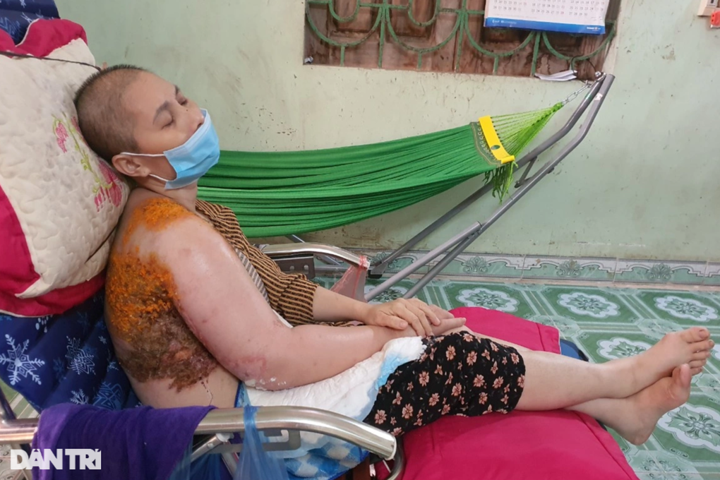 Người mẹ ung thư nghẹn ngào em không còn nước mắt để khóc - 3 Người mẹ ung thư nghẹn ngào em không còn nước mắt để khóc - 3
