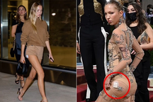 Con gái siêu mẫu Kate Moss khoe chân dài và... máy đo đường huyết