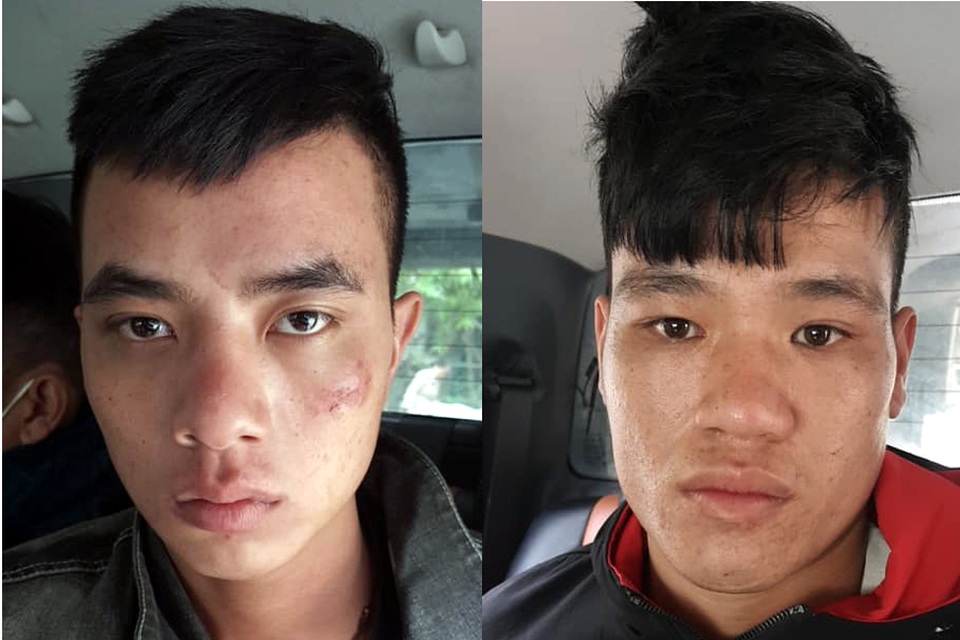 Hà Nội: Bắt 2 đối tượng dùng dao và ống kim tiêm đe dọa, cướp xe máy - 1 Hà Nội: Bắt 2 đối tượng dùng dao và ống kim tiêm đe dọa, cướp xe máy - 1