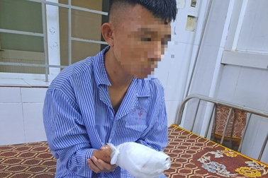 Nam thanh niên bị chém gần đứt lìa ba ngón tay ở quán ăn vặt