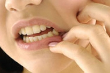 Hàng loạt “rắc rối” vì răng khôn