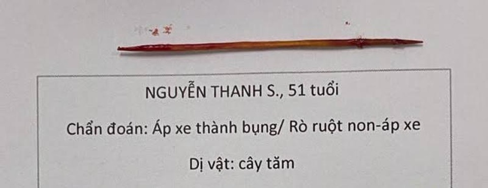 Người đàn ông bị tăm xỉa răng đâm thủng ruột, đâm xuyên thành bụng - 1 Người đàn ông bị tăm xỉa răng đâm thủng ruột, đâm xuyên thành bụng - 1