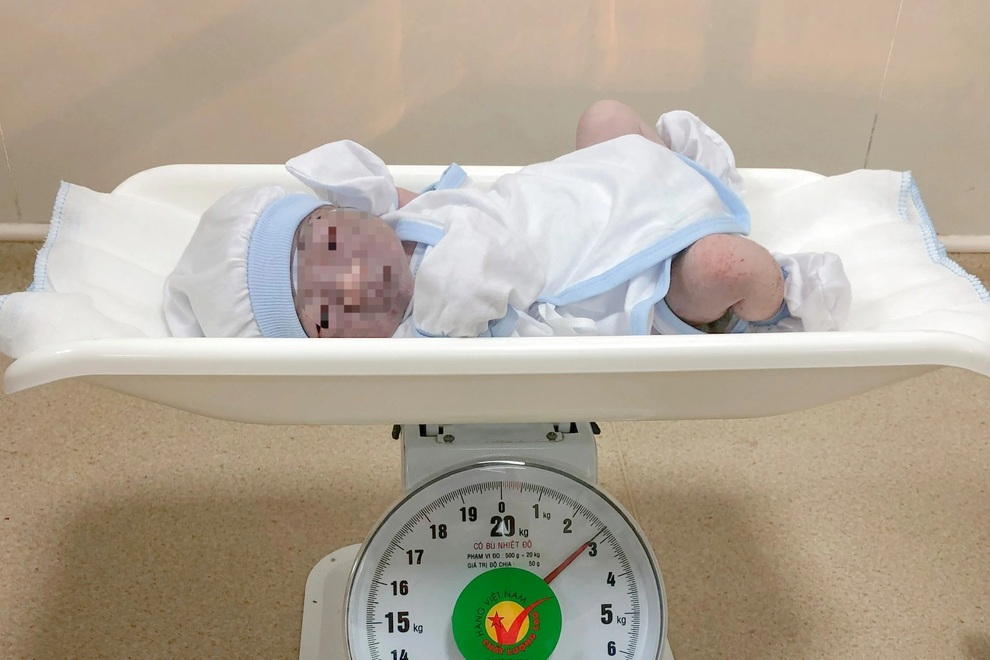 Cấp cứu kịp thời sản phụ đẻ rơi ngay trên ô tô trước cổng bệnh viện - 1