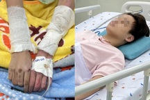 Bé gái "đen kịt" khi vào viện, cha mẹ cũng bỏng nặng trong vụ cháy ở TPHCM