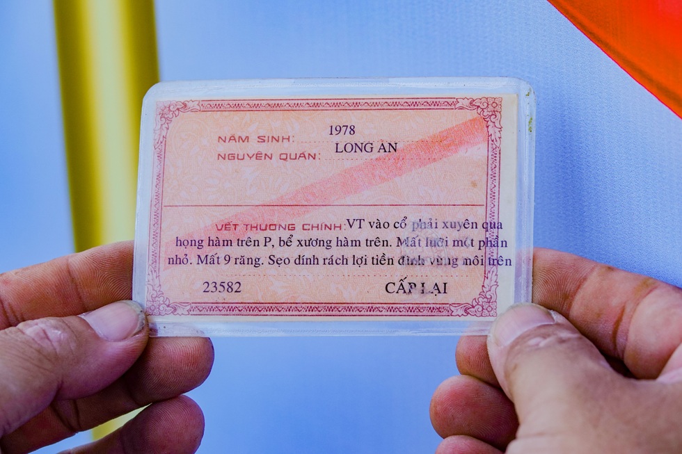 Người đàn ông bắt cướp bị bắn vỡ mặt: Từ cõi chết về xây cơ ngơi bạc tỷ - 5 Người đàn ông bắt cướp bị bắn vỡ mặt: Từ cõi chết về xây cơ ngơi bạc tỷ - 5