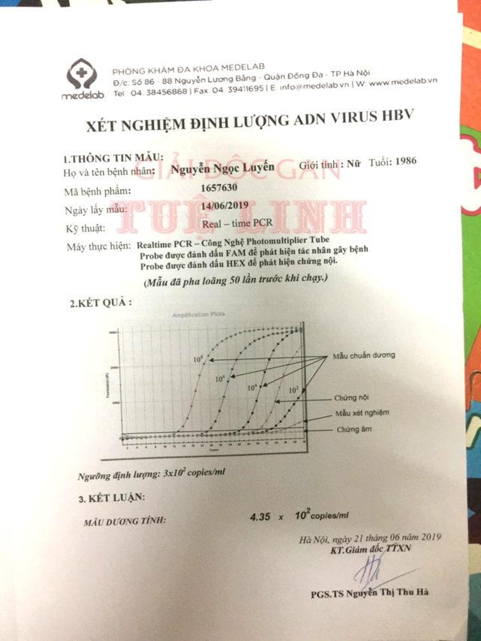 Virus viêm gan B bùng phát sau sinh và hành trình 6 tháng để âm tính của cô gái trẻ! - 2 Virus viêm gan B bùng phát sau sinh và hành trình 6 tháng để âm tính của cô gái trẻ! - 2