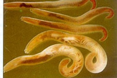 Viêm màng não do ký sinh trùng trong thực phẩm 