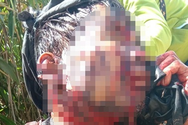 Một người Quảng Nam bị gấu tấn công trọng thương