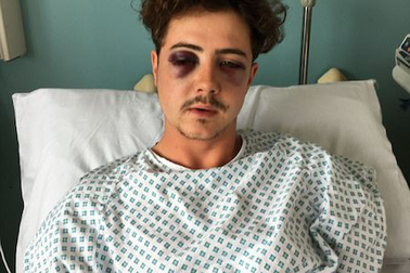 Cổ động viên Tottenham tự “dần” nhau nhừ tử vì… Chelsea