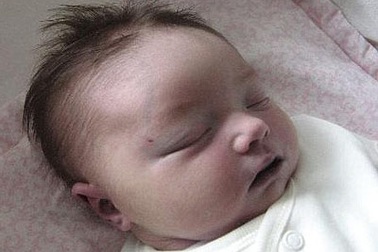 Dùng thủ thuật forcep, 1 trẻ sơ sinh tử vong