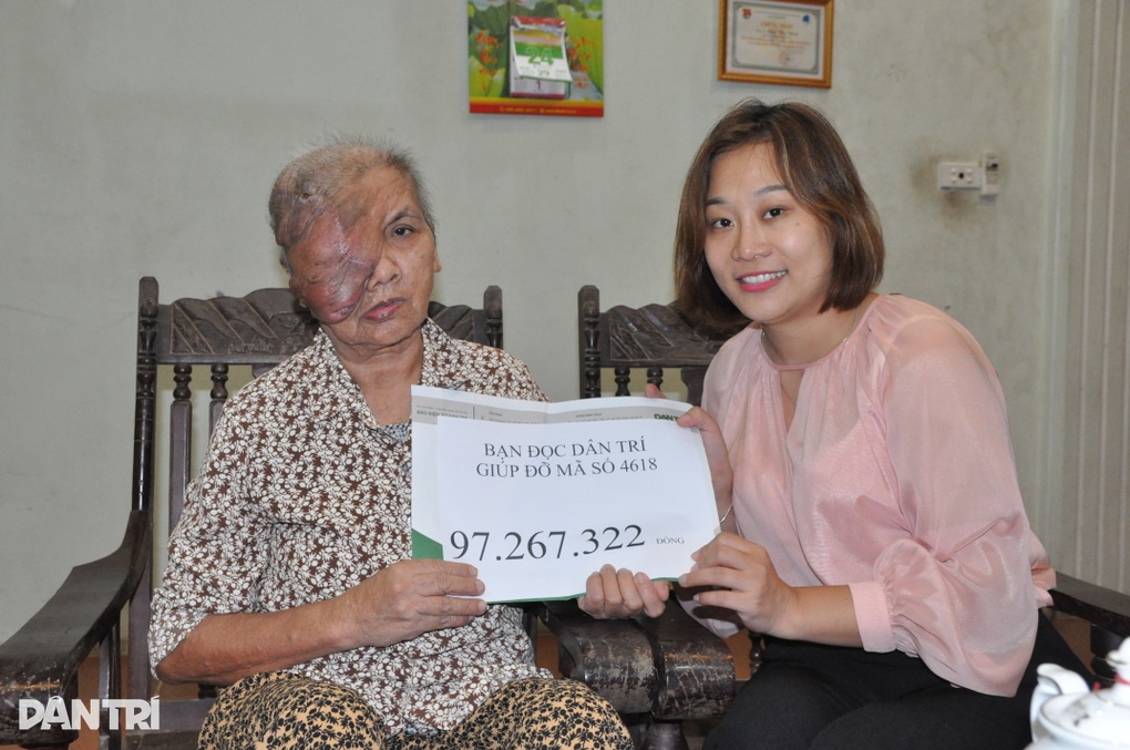 Người đàn bà có khối u khổng lồ bước đầu phẫu thuật thành công - 5 Người đàn bà có khối u khổng lồ bước đầu phẫu thuật thành công - 5