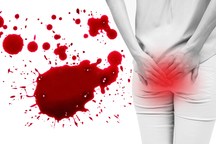 Từ chối mổ về nhà ăn Tết, bệnh nhân trĩ mất 2/3 lượng máu cơ thể