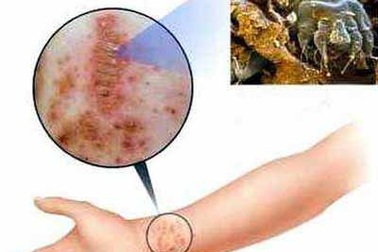 Thuốc bôi ngoài da: Lợi và hại