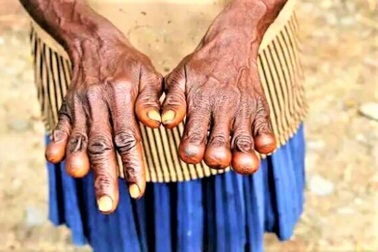 Rùng rợn hủ tục cắt bỏ ngón tay khi người thân chết ở bộ tộc sống ẩn dật