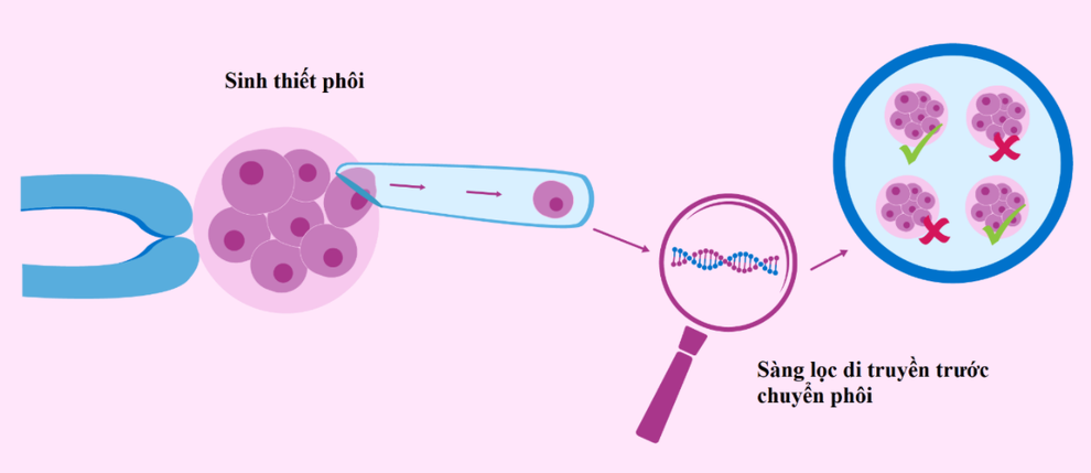 Triển khai kỹ thuật PGT-M trong sàng lọc phôi tiền làm tổ các bệnh hiếm - 1 Triển khai kỹ thuật PGT-M trong sàng lọc phôi tiền làm tổ các bệnh hiếm - 1