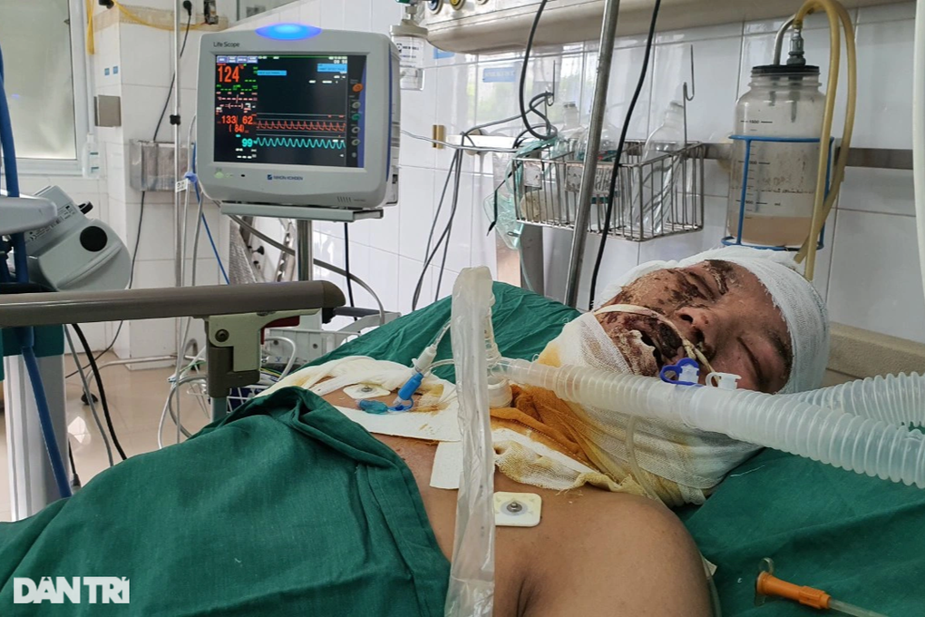 Xin cứu giúp chàng trai nghèo hiếu thảo bị phóng điện như ngọn đuốc sống - 2 Xin cứu giúp chàng trai nghèo hiếu thảo bị phóng điện như ngọn đuốc sống - 2